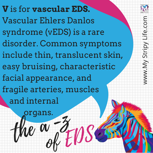 V is for vascular EDS